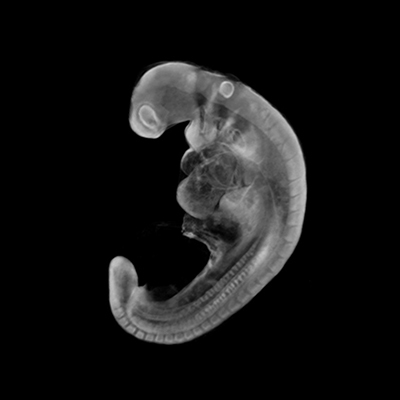 A 3D model of a human embryo, Carnegie stage 11