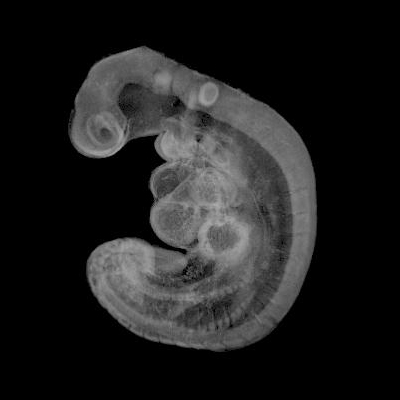 A 3D model of a human embryo, Carnegie stage 12