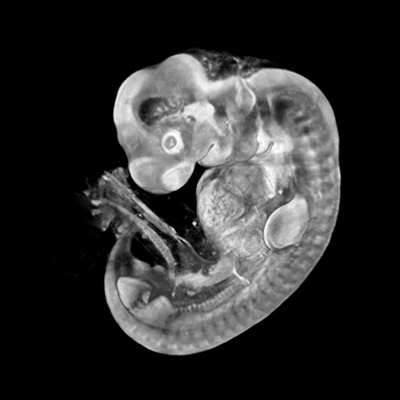A 3D model of a human embryo, Carnegie stage 14