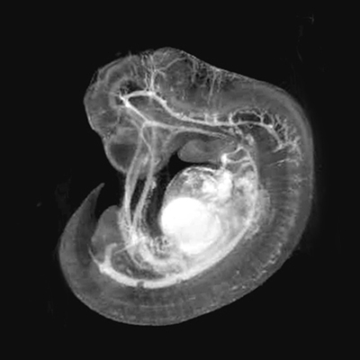 A 3D model of a human embryo, Carnegie stage 16