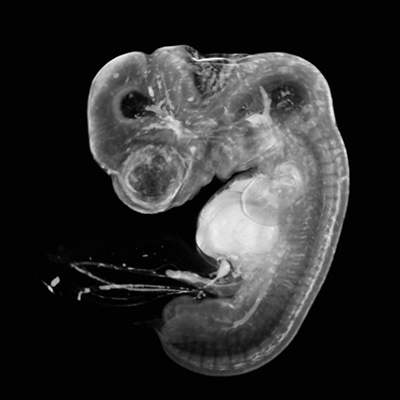 A 3D model of a human embryo, Carnegie stage 17
