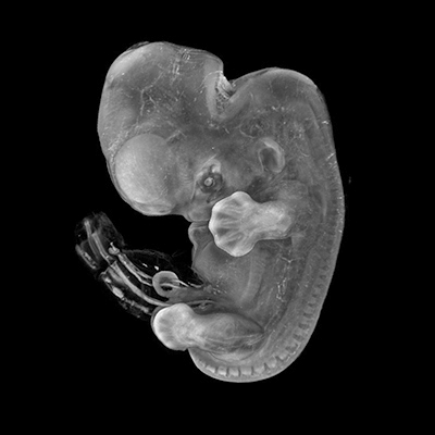 A 3D model of a human embryo, Carnegie stage 18
