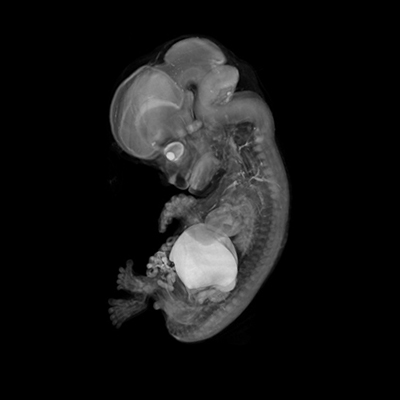 A 3D model of a human embryo, Carnegie stage 23