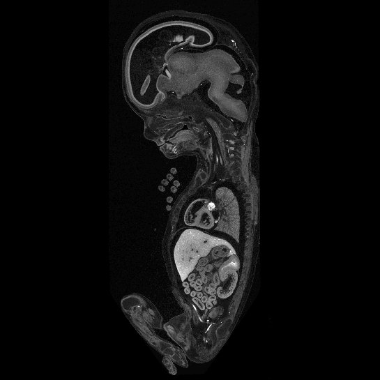 A 3D model of a human fetus