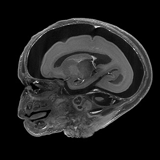 A 3D model of a human fetal brain