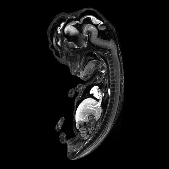 A 3D model of a human fetus