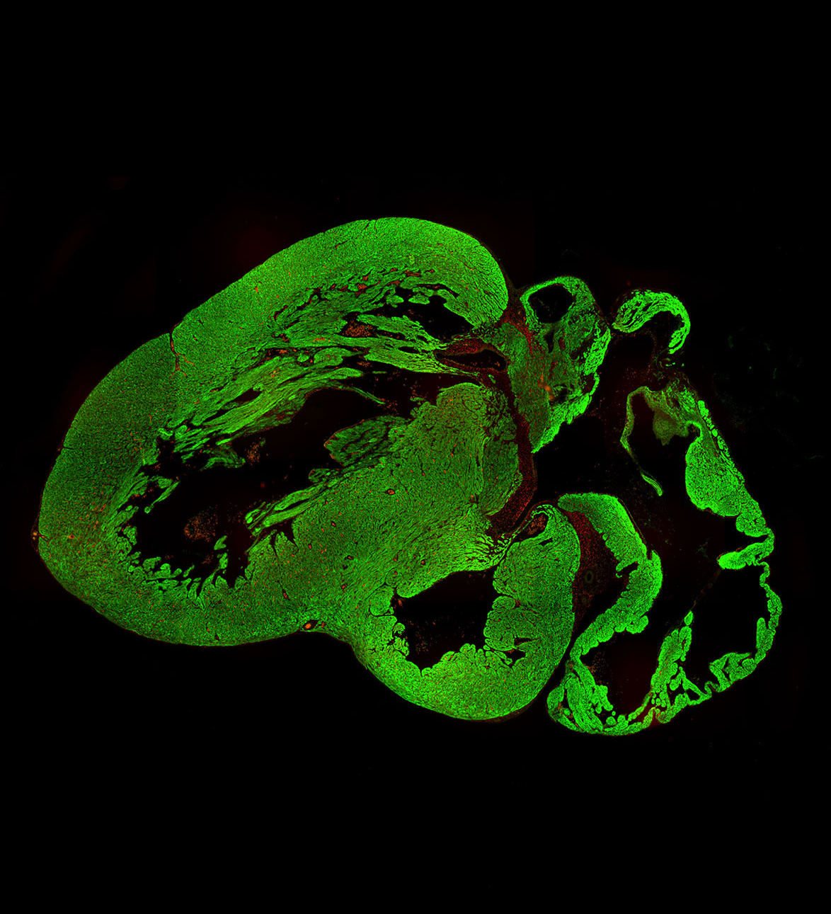 Human fetal heart