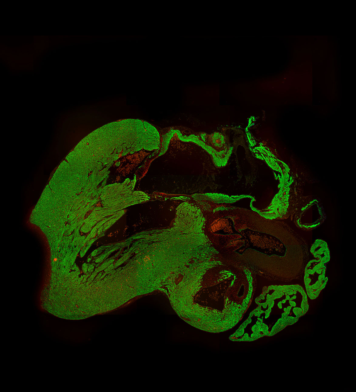 Human fetal heart