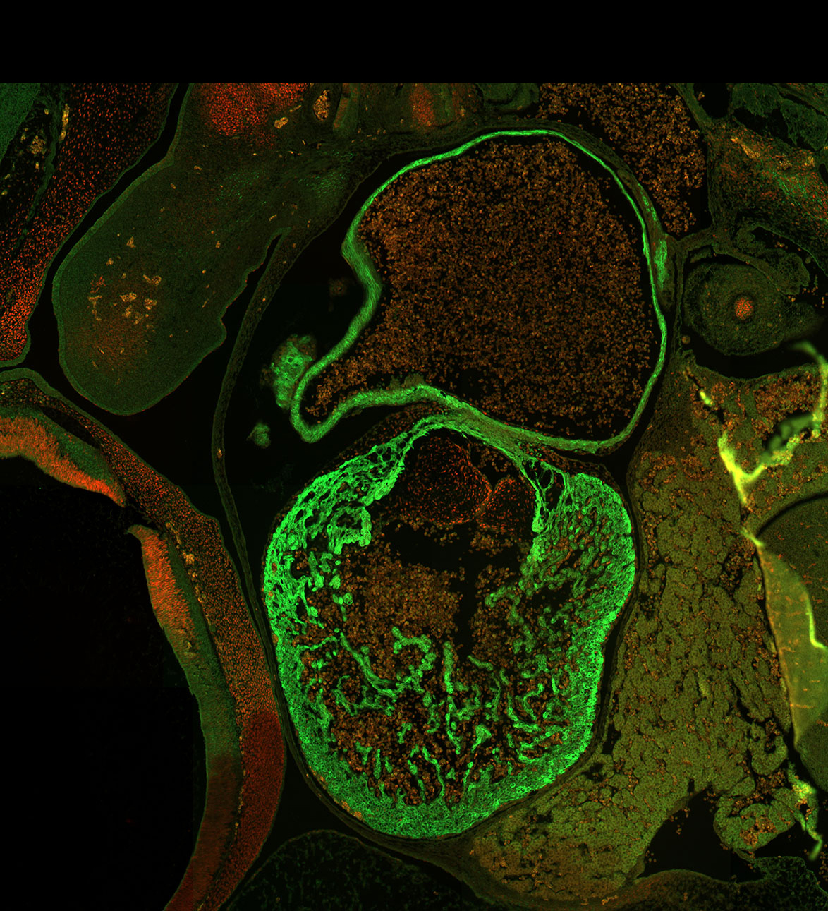 Human embryonic heart