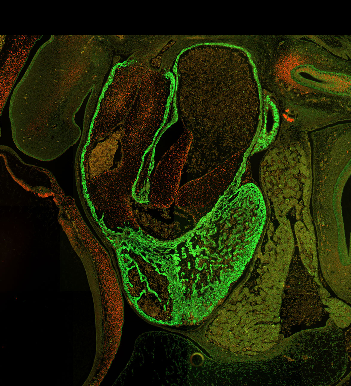 Human embryonic heart