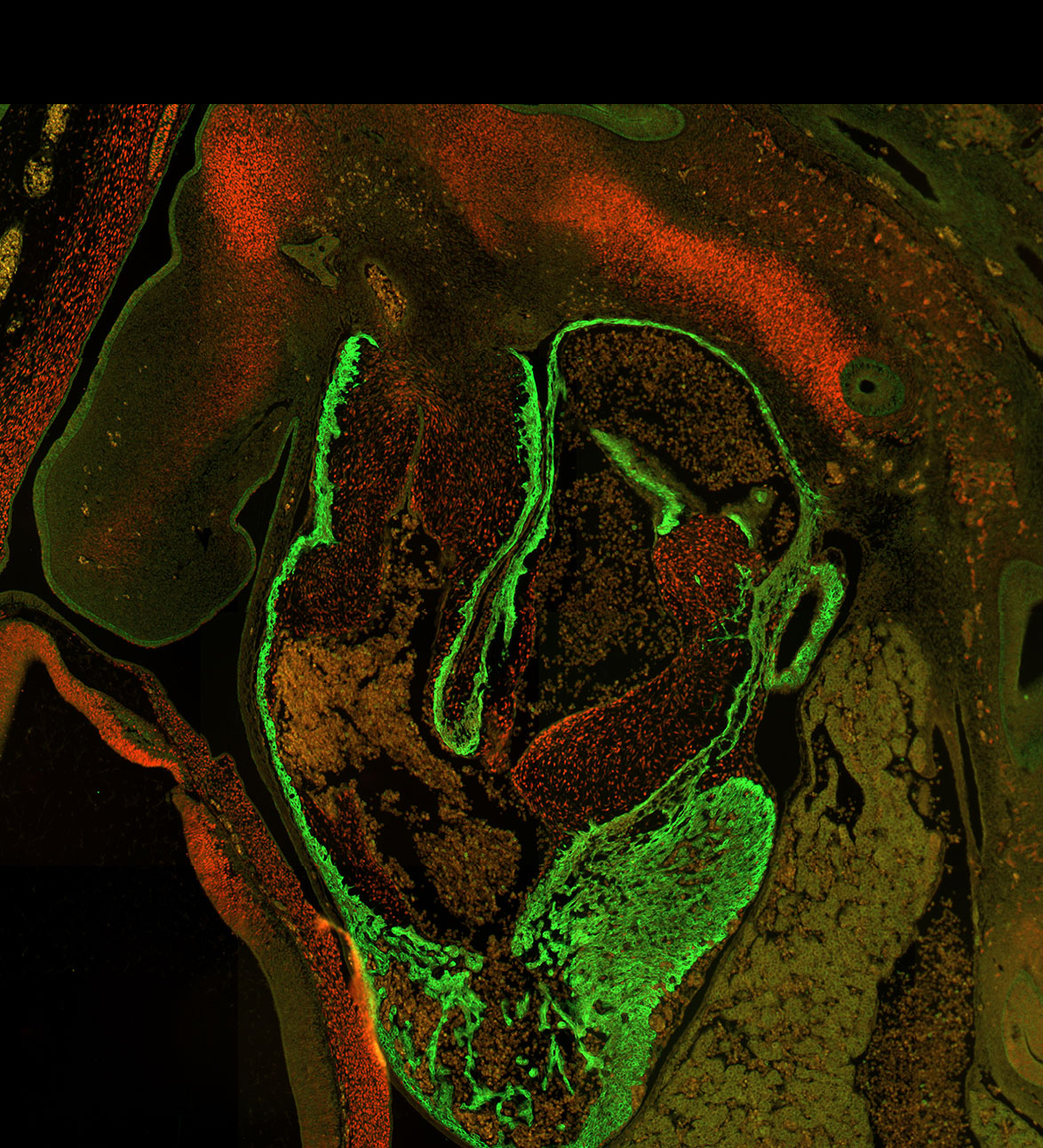 Human embryonic heart
