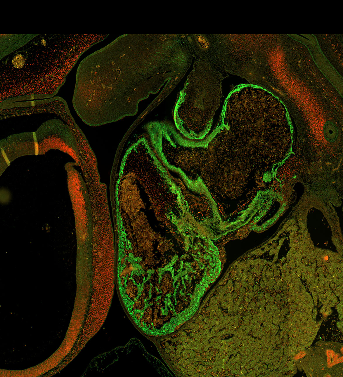 Human embryonic heart