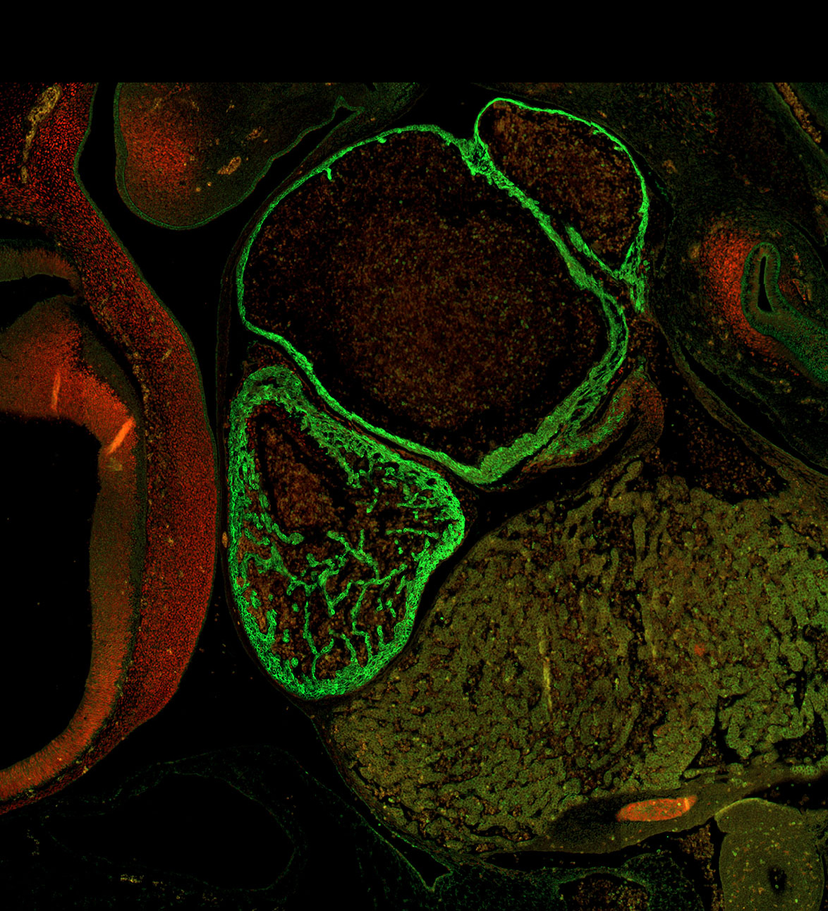 Human embryonic heart