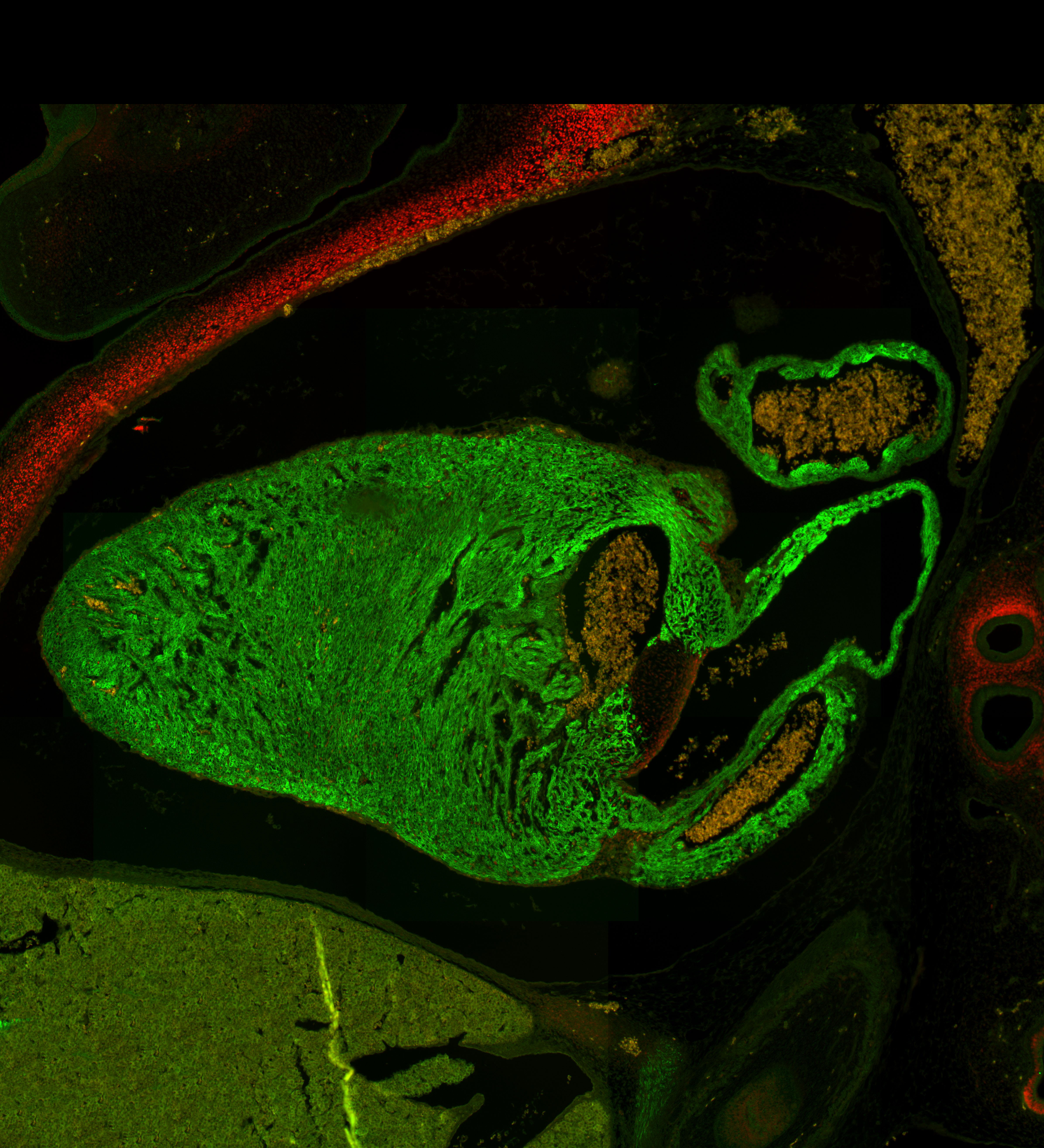 Human embryonic heart