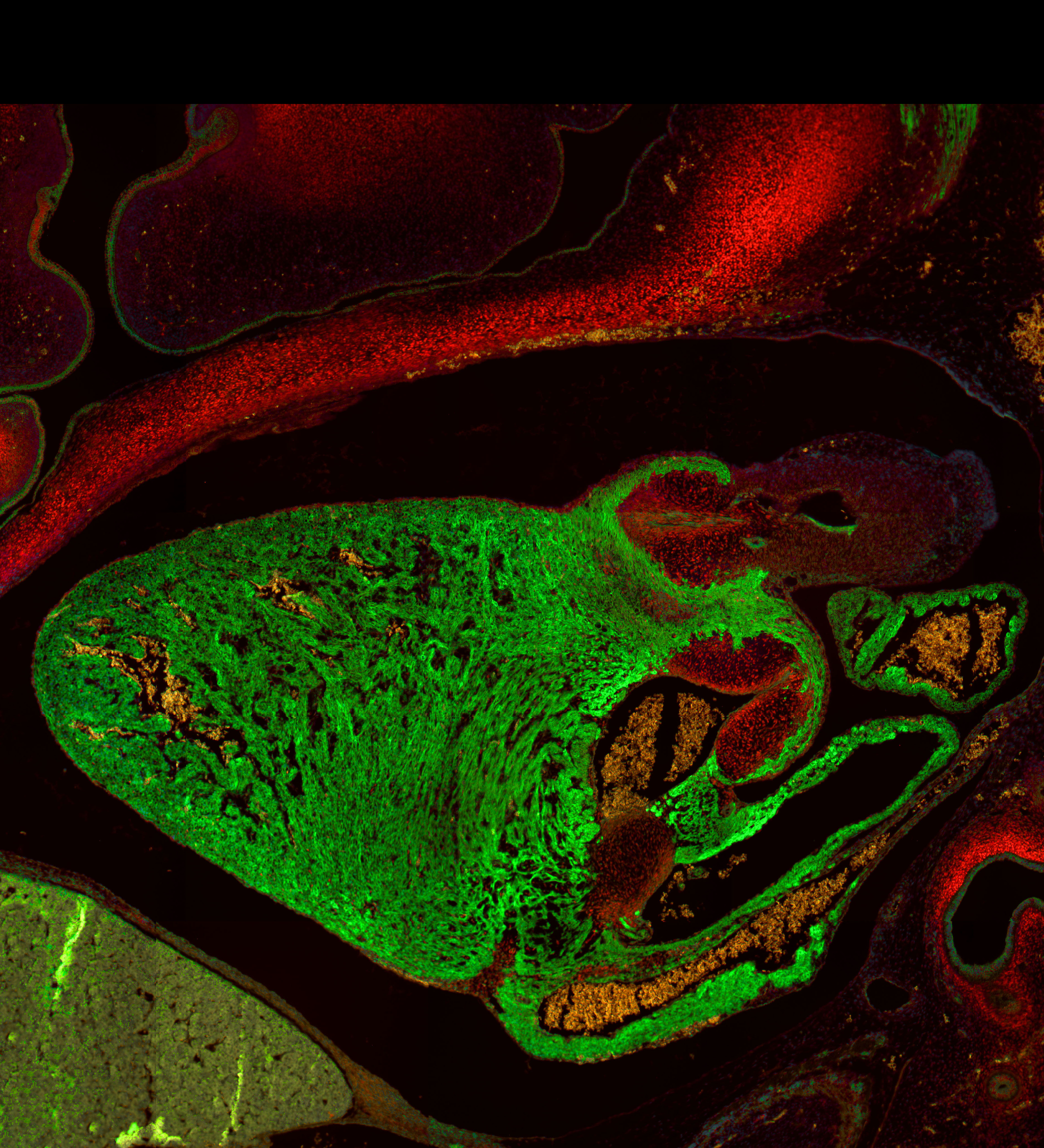 Human embryonic heart