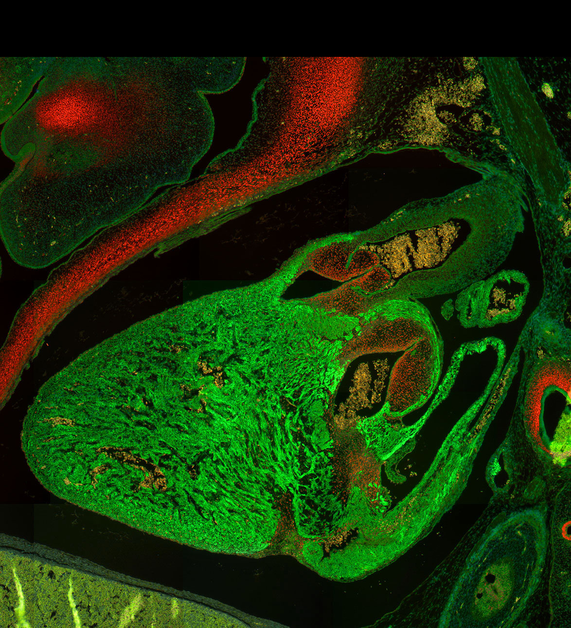 Human embryonic heart