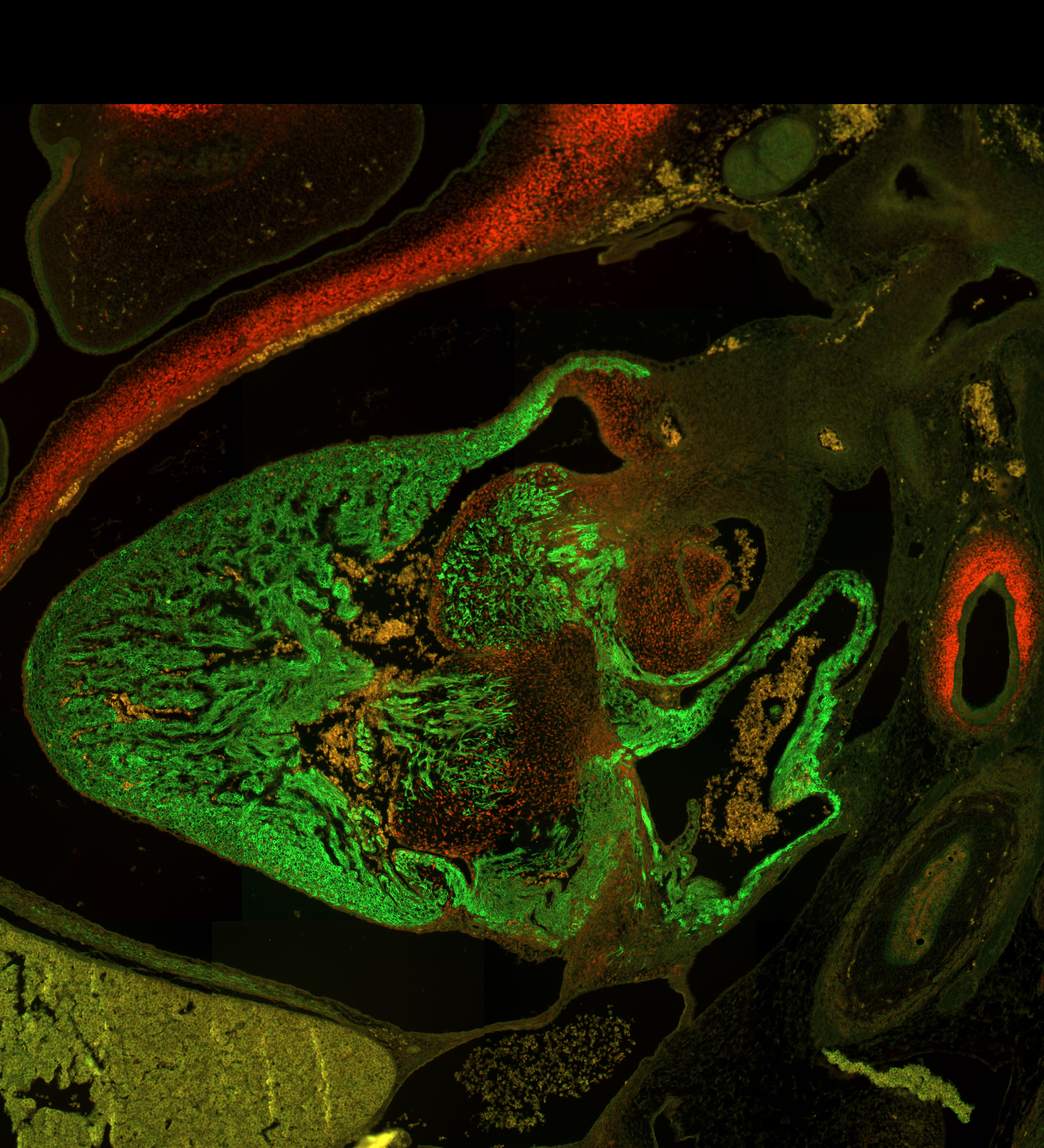 Human embryonic heart