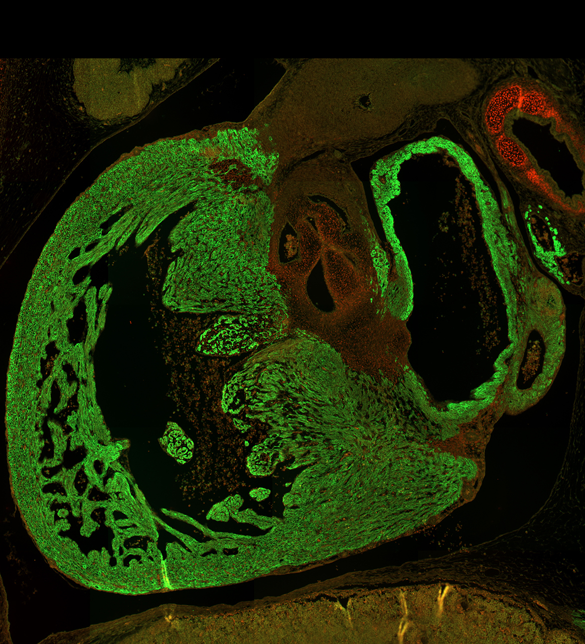 Human embryonic heart