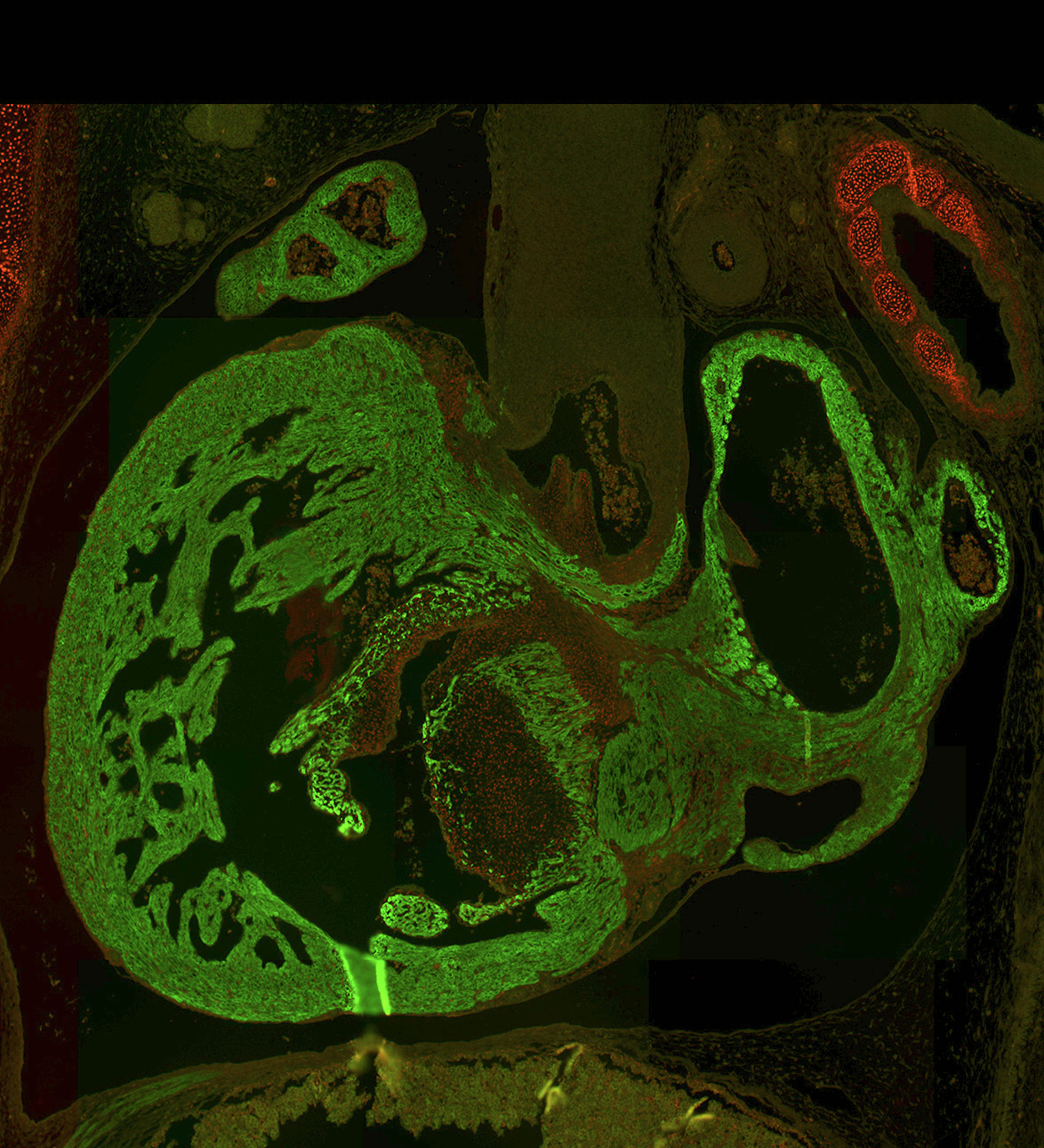 Human embryonic heart