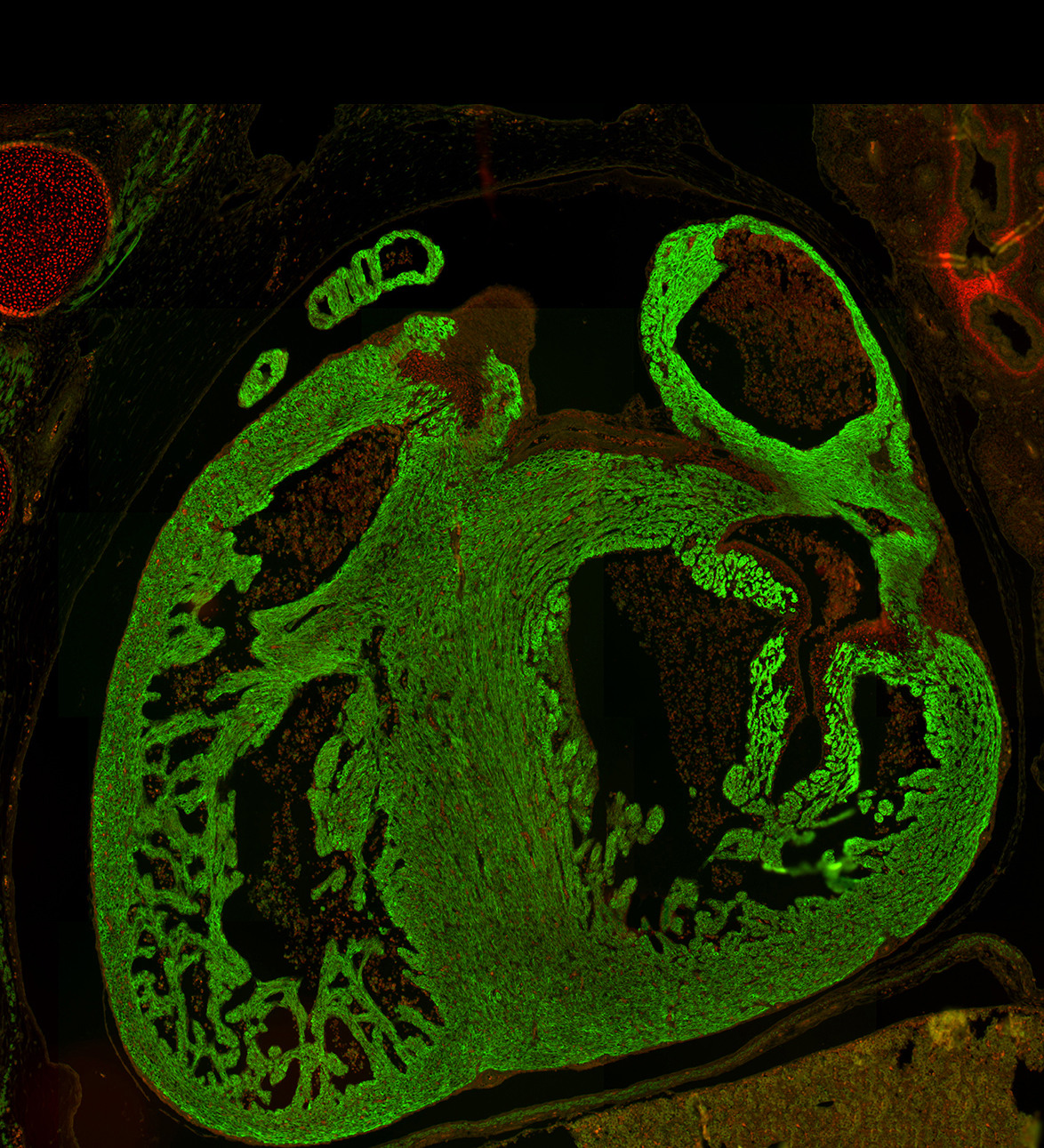 Human embryonic heart