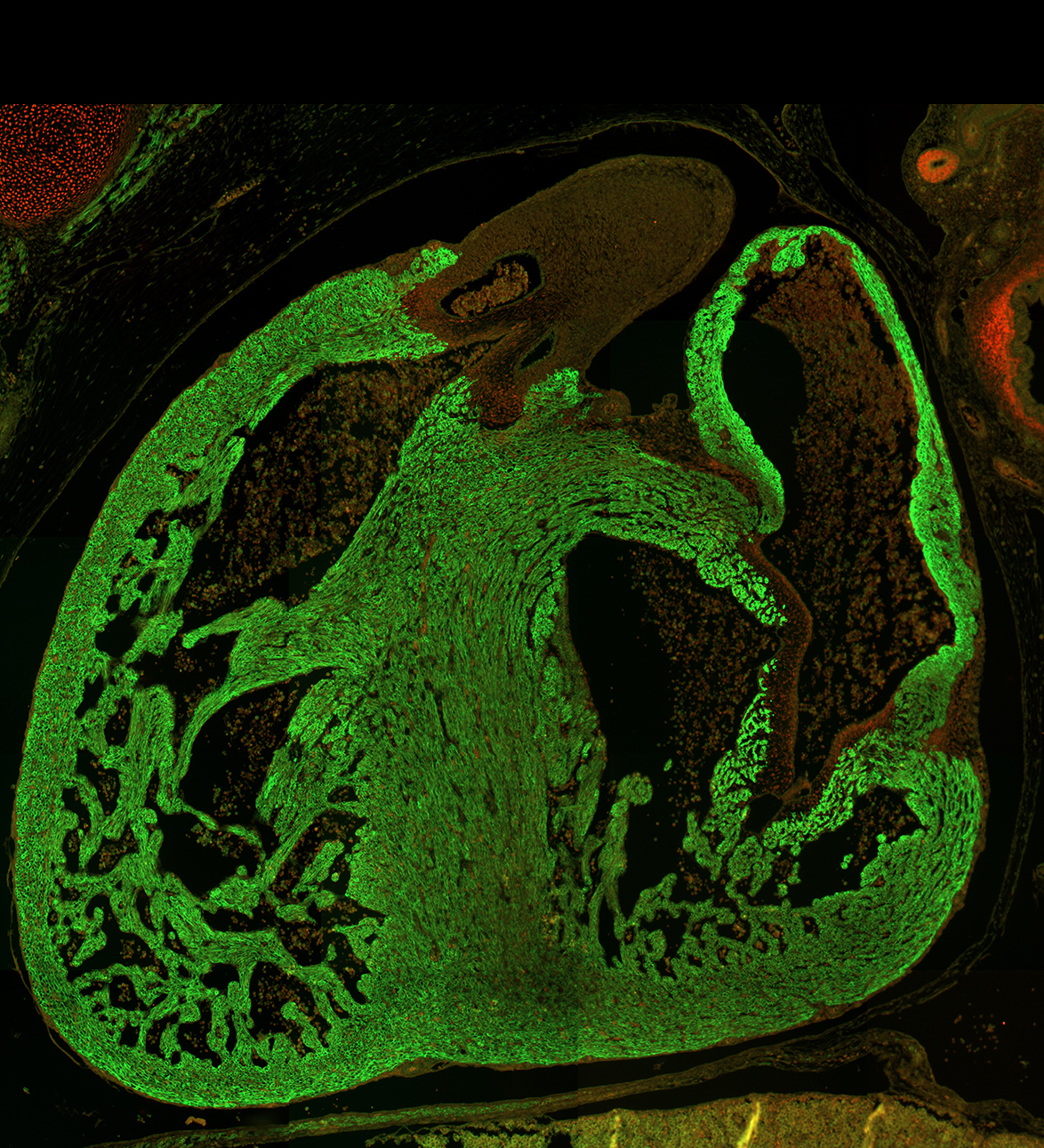 Human embryonic heart