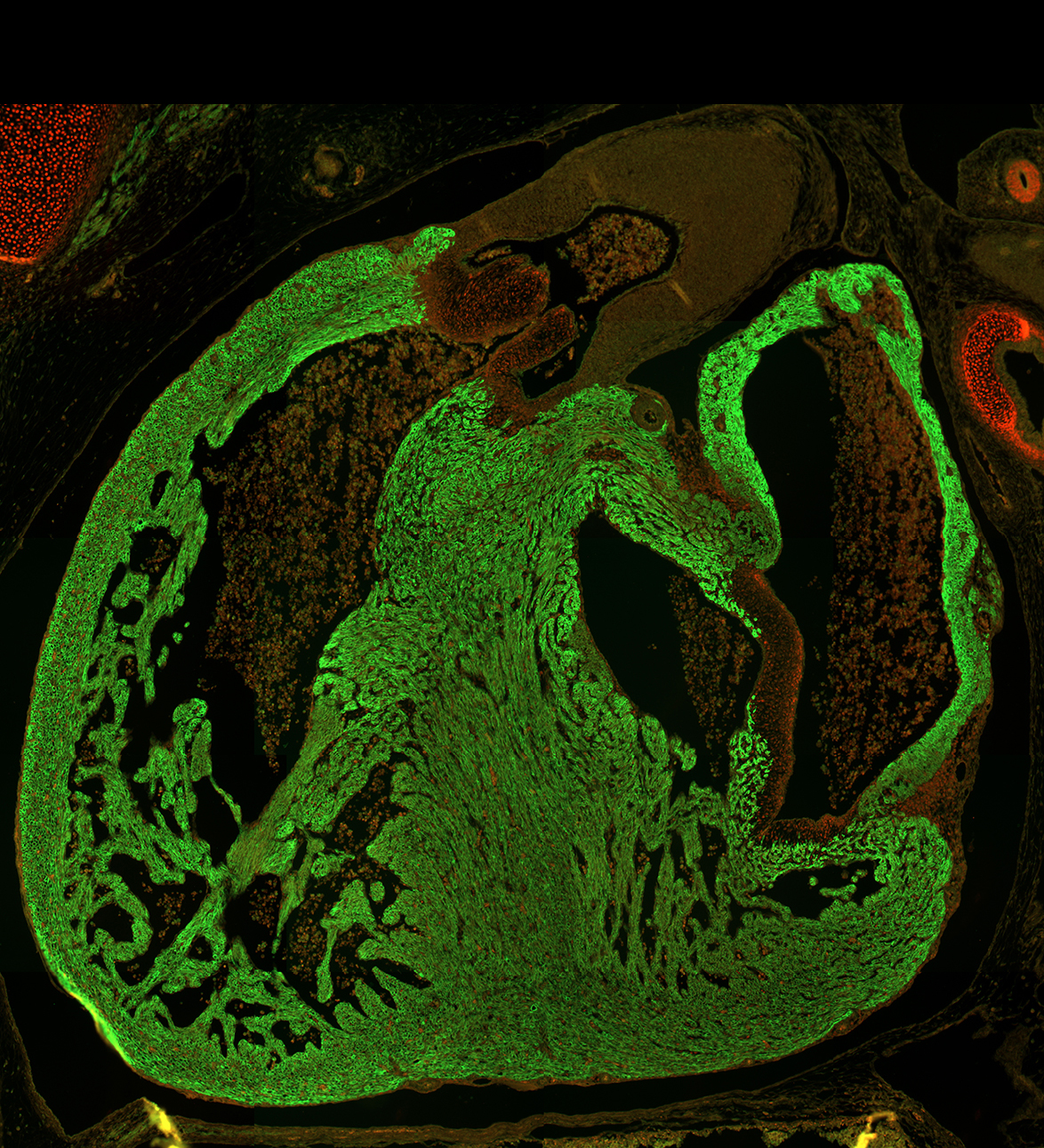 Human embryonic heart