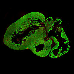 10PCW human fetal heart