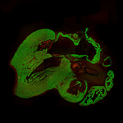 10PCW human fetal heart