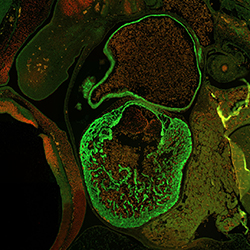 CS16 human embryonic heart