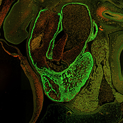 CS16 human embryonic heart