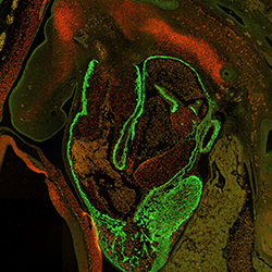 CS16 human embryonic heart