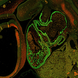 CS16 human embryonic heart