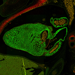 CS20 human embryonic heart