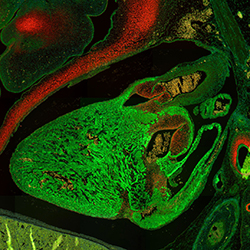 CS20 human embryonic heart