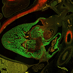 CS20 human embryonic heart