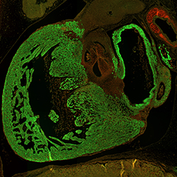 CS23 human embryonic heart