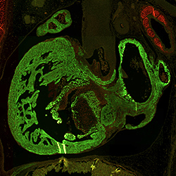 CS23 human embryonic heart