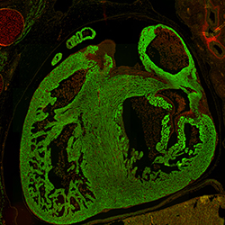 CS23 human embryonic heart