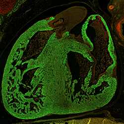 CS23 human embryonic heart