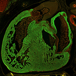CS23 human embryonic heart