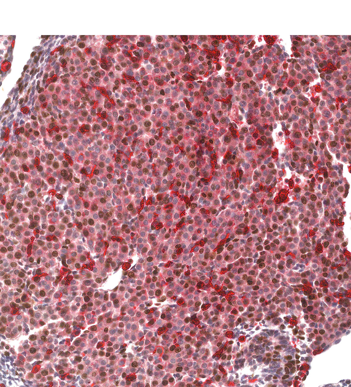 CS12 Human embryo