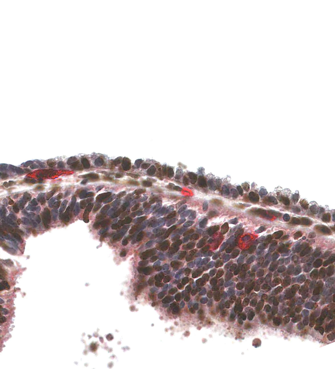 CS12 Human embryo