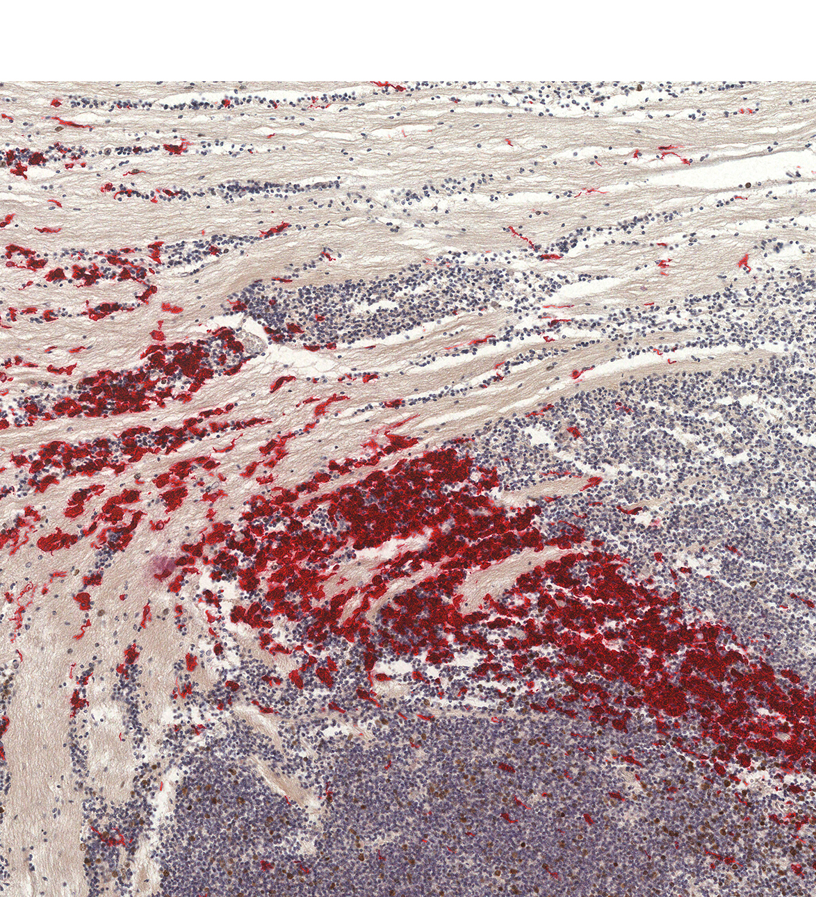 14PCW Human fetal brain