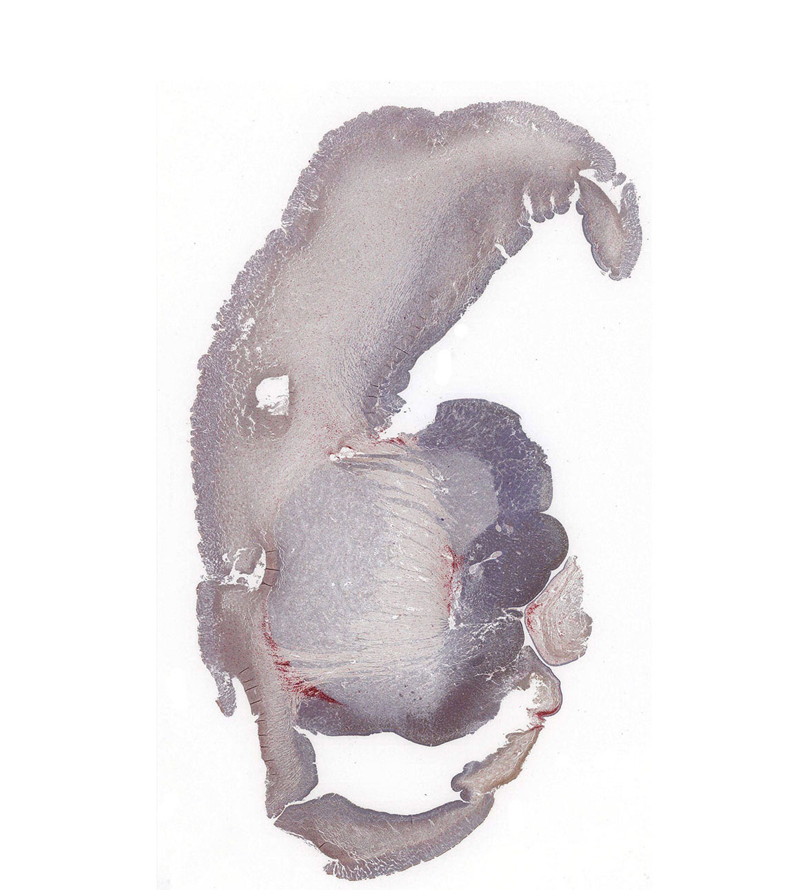 14PCW Human fetal brain