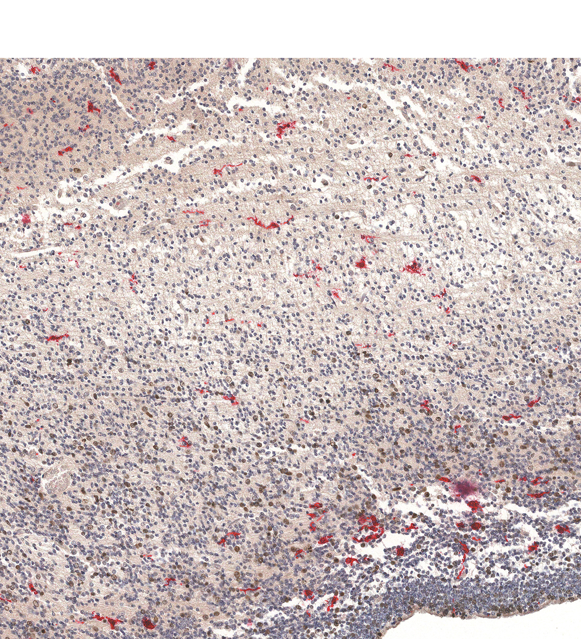 14PCW Human fetal brain