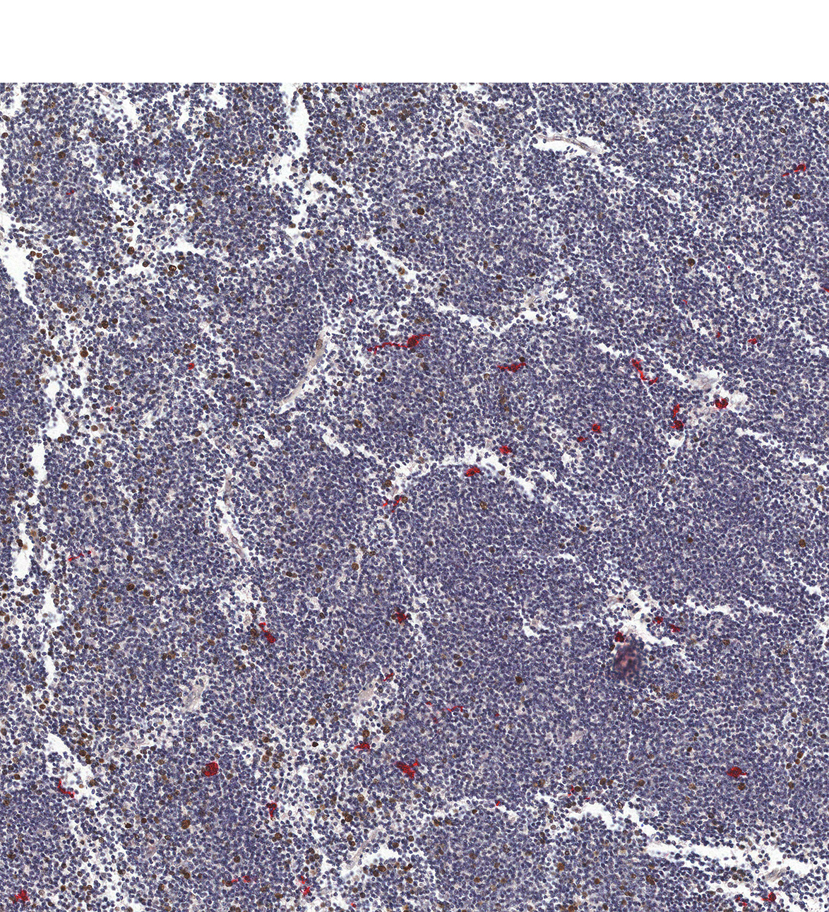 14PCW Human fetal brain