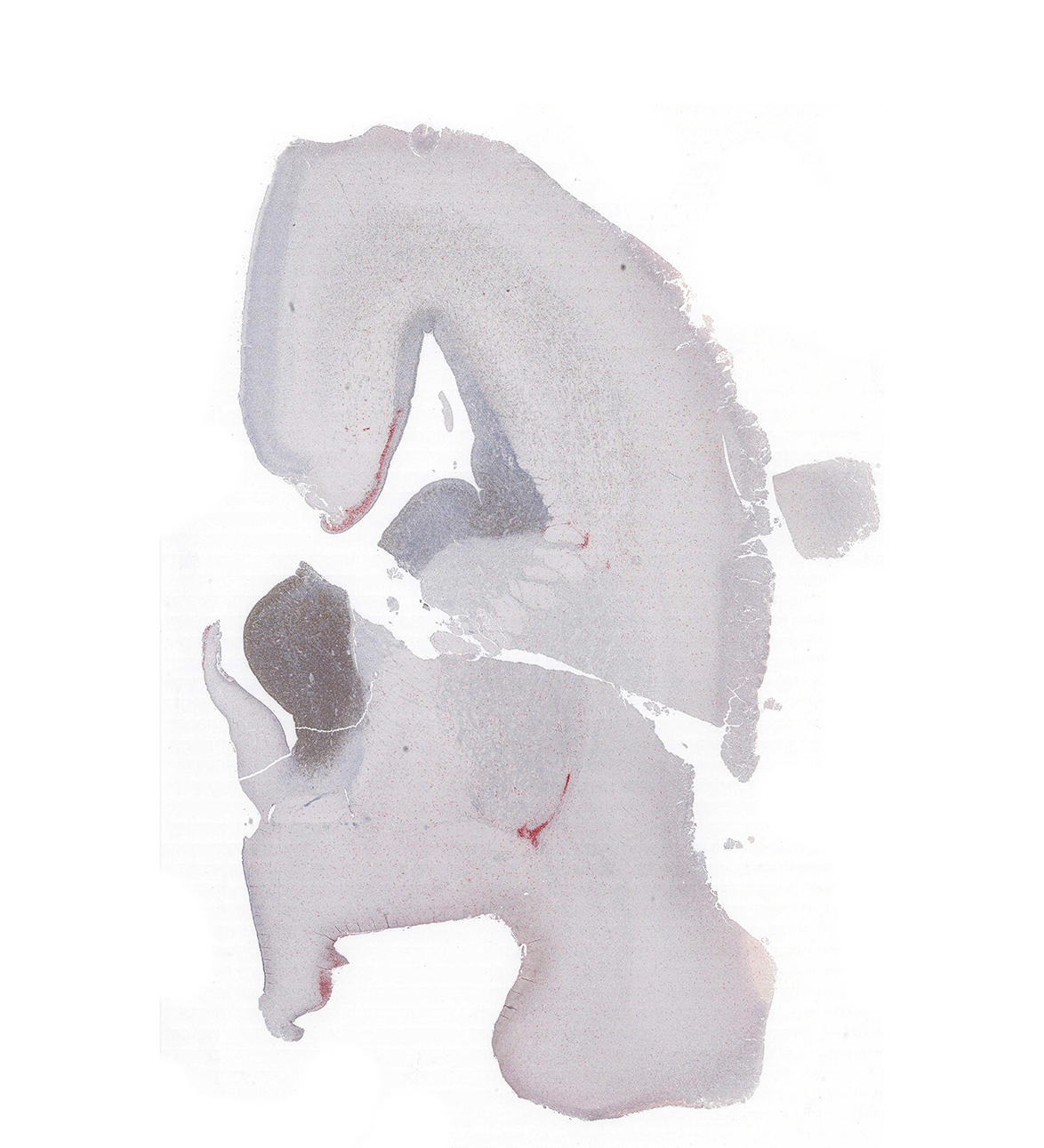 17PCW Human fetal brain