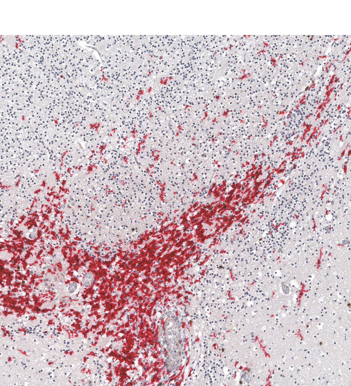 17PCW Human fetal brain