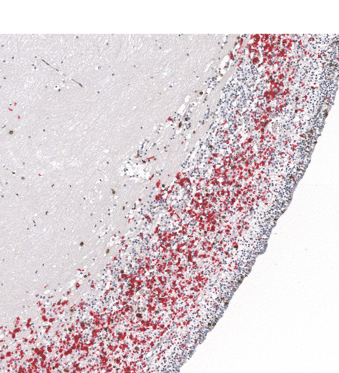 17PCW Human fetal brain