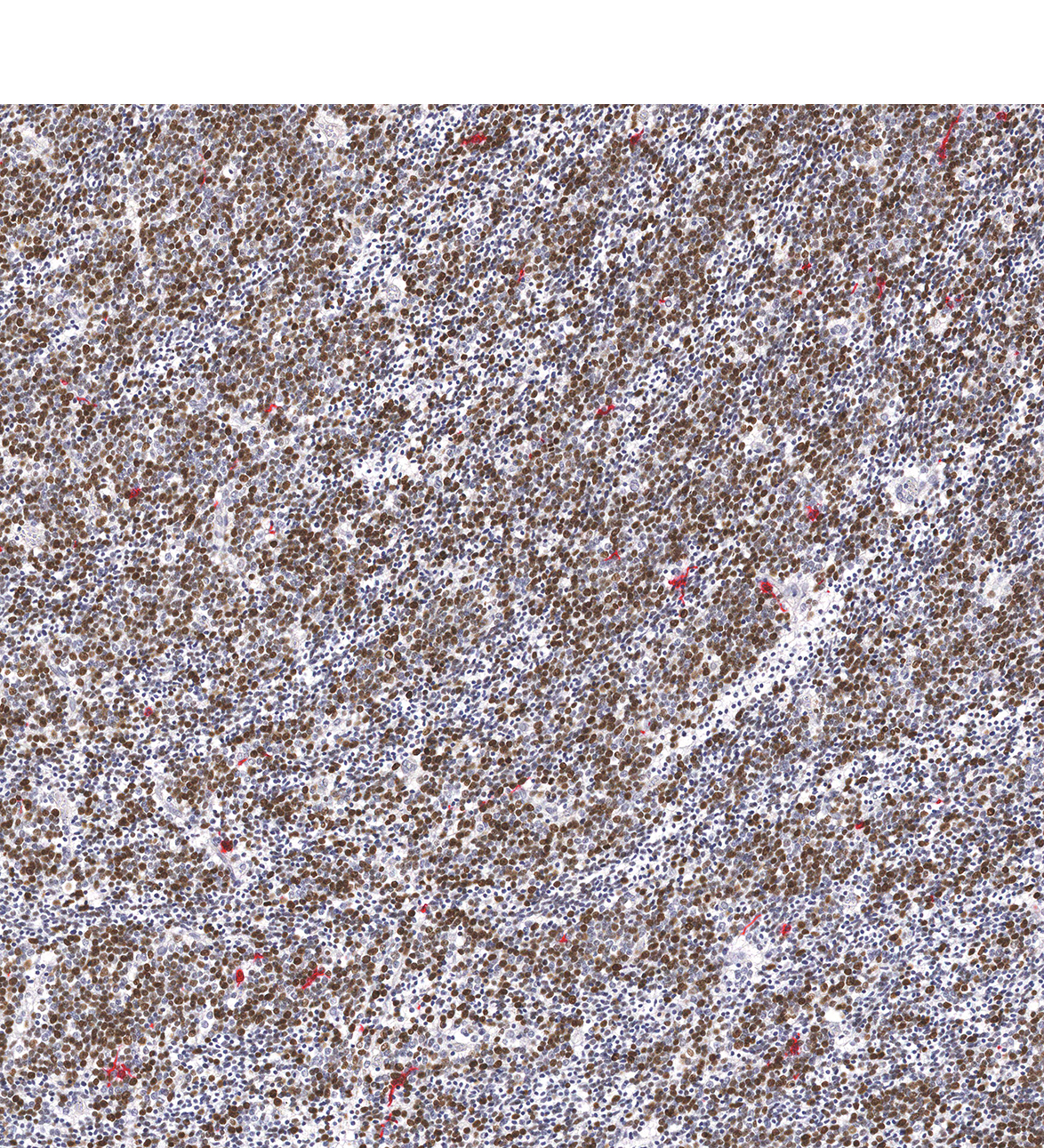 17PCW Human fetal brain